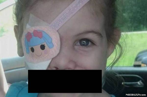 В США выгнали девочку из ресторан KFC из-за шрамов на лице (3 фото)